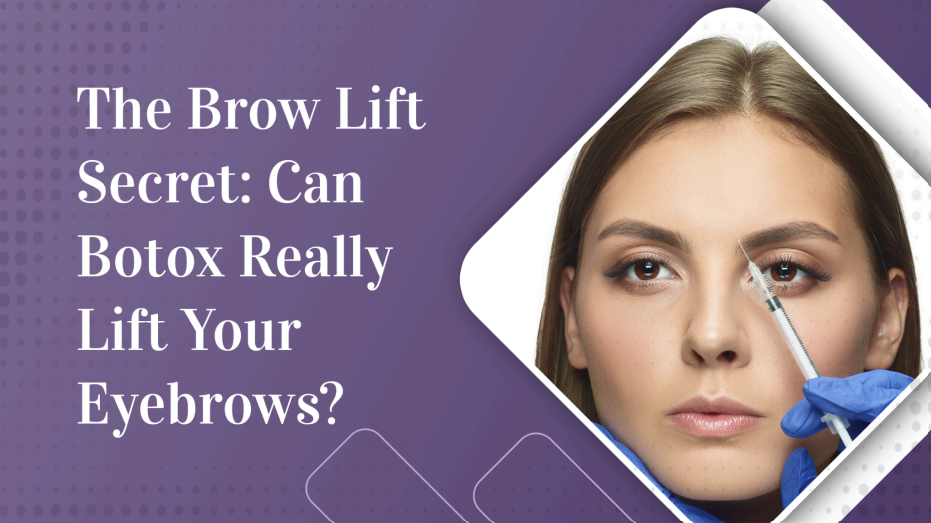 The Brow Lift Secret: Can Botox Really Lift Your Eyebrows?