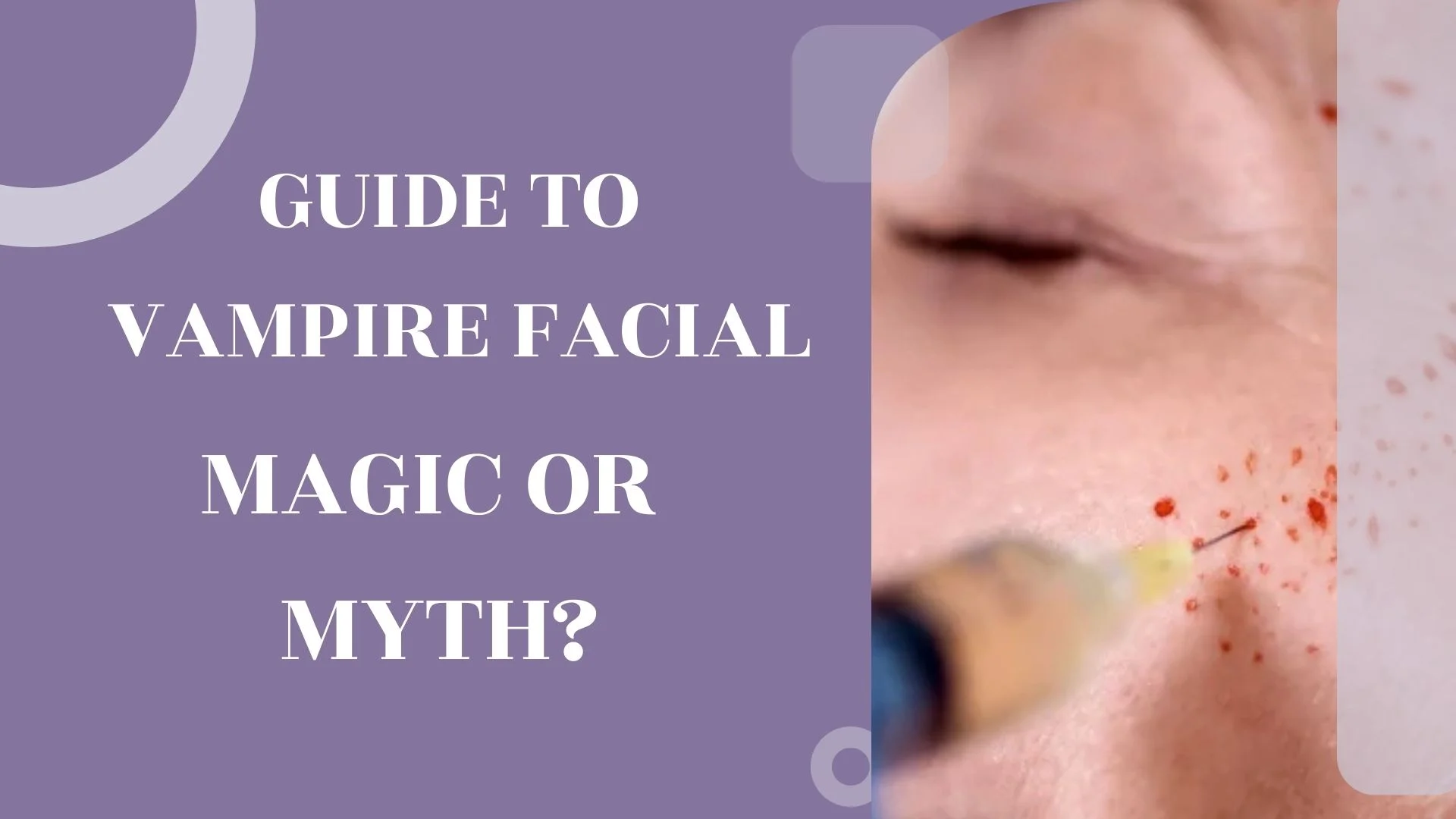 Your Guide to Vampire Facials: Magic or Myth?