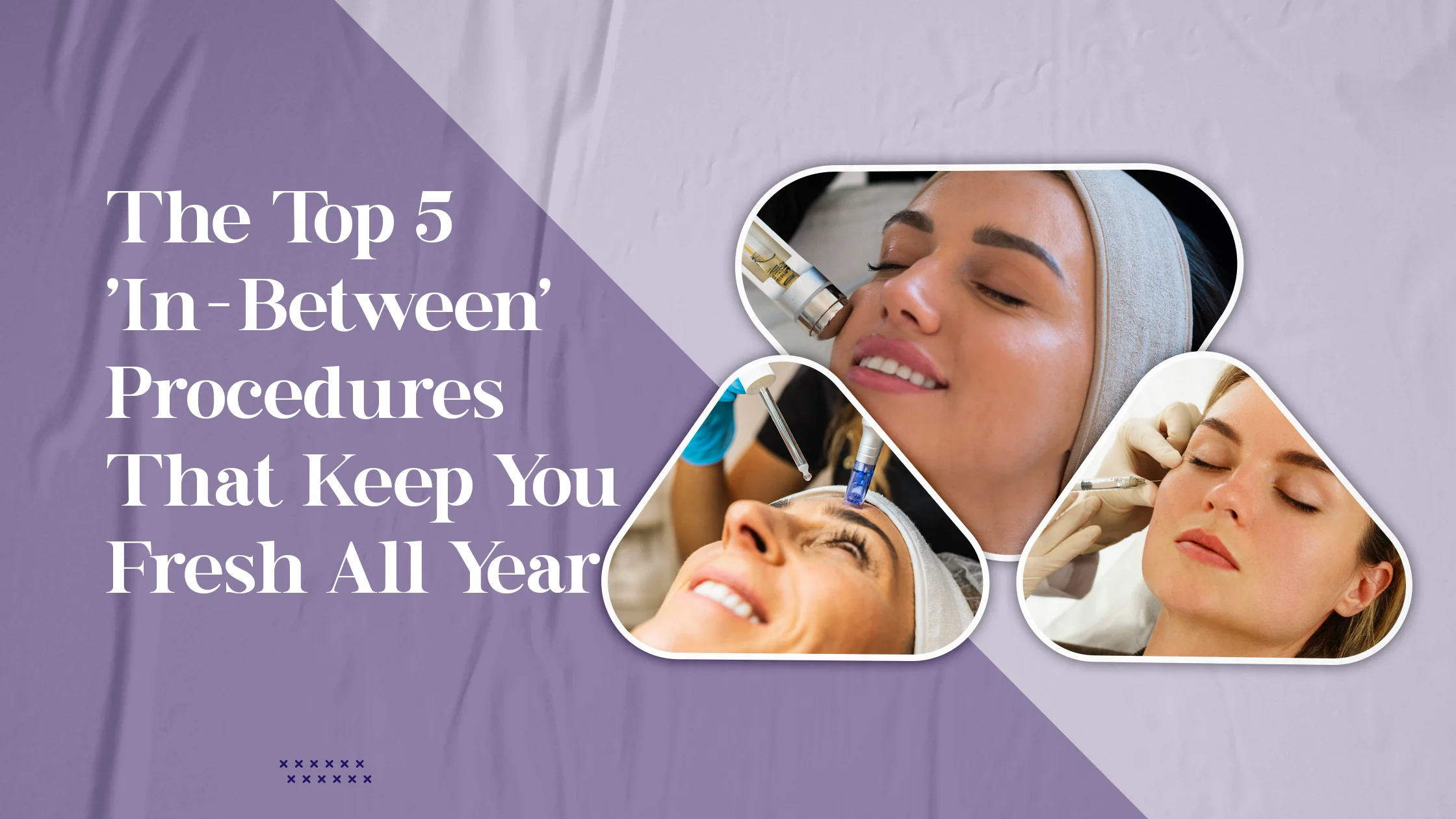 The Top 5 ‘In-Between’ Procedures That Keep You Fresh All Year