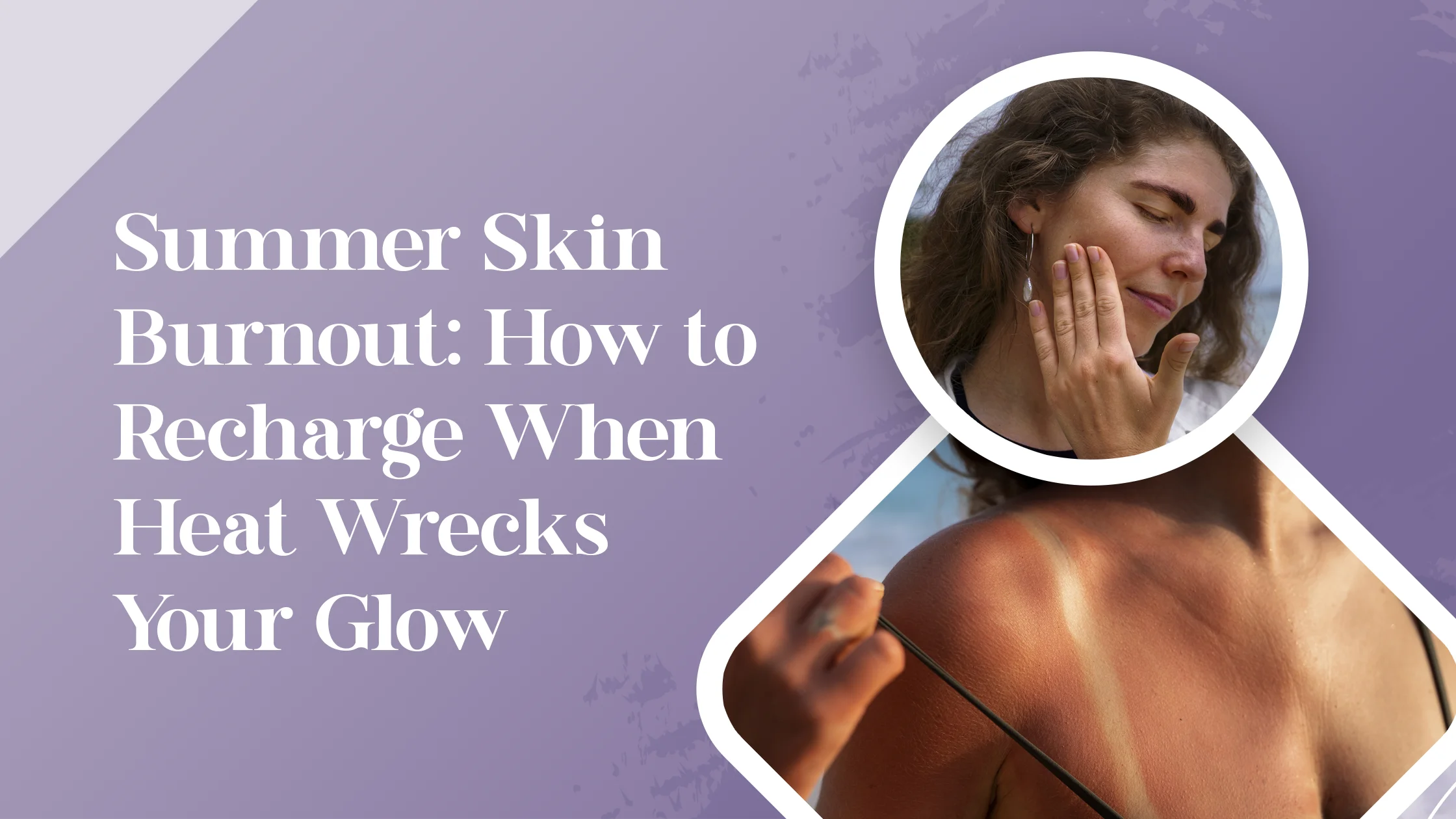 Summer Skin Burnout: How to Recharge When Heat Wrecks Your Glow