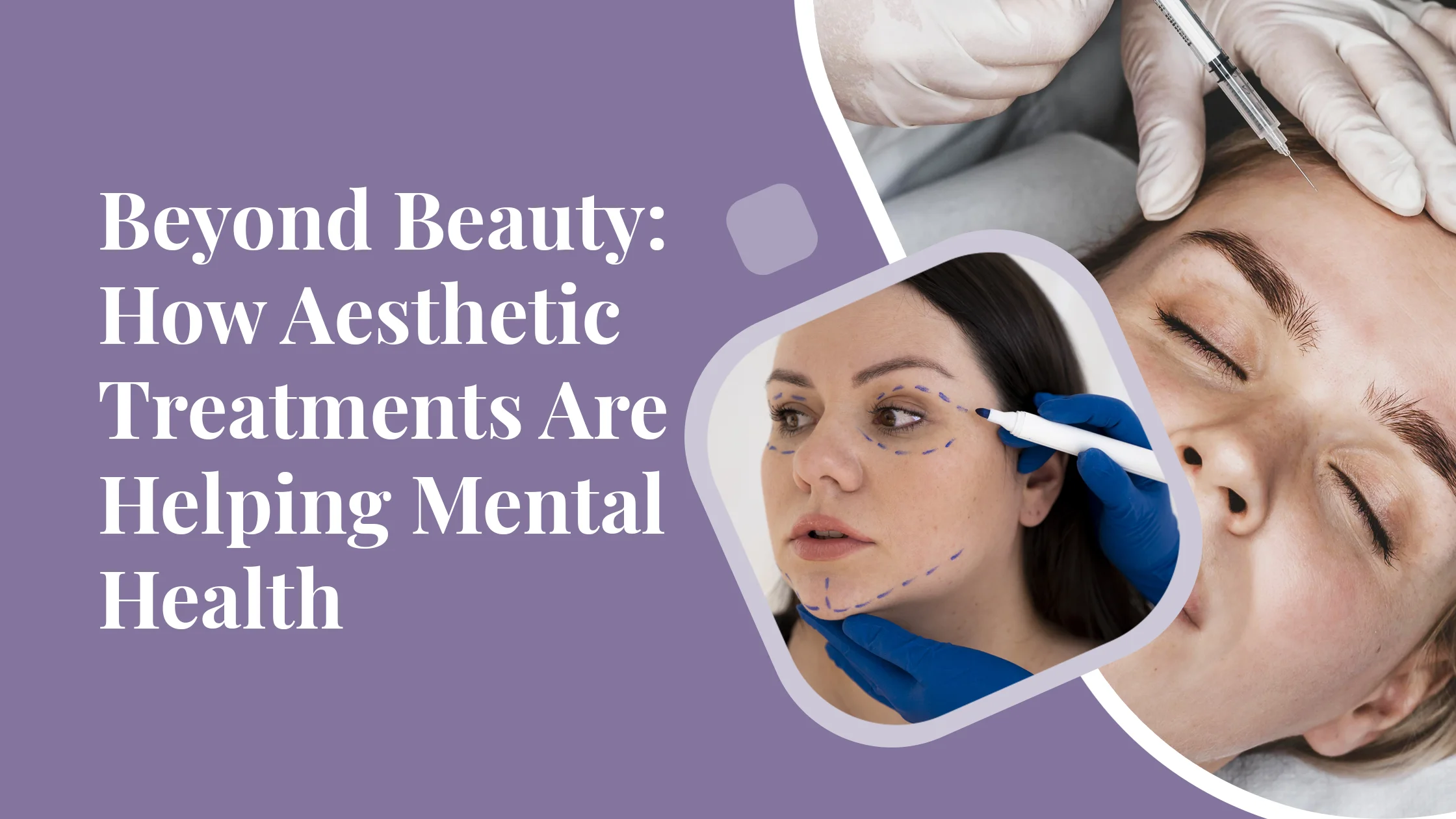 Beyond Beauty: How Aesthetic Treatments Are Helping Mental Health